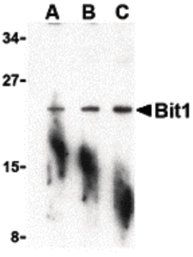 IHC-plus™ PTRH2 / BIT1 Antibody