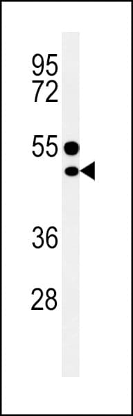CD1E Antibody (aa184-212)