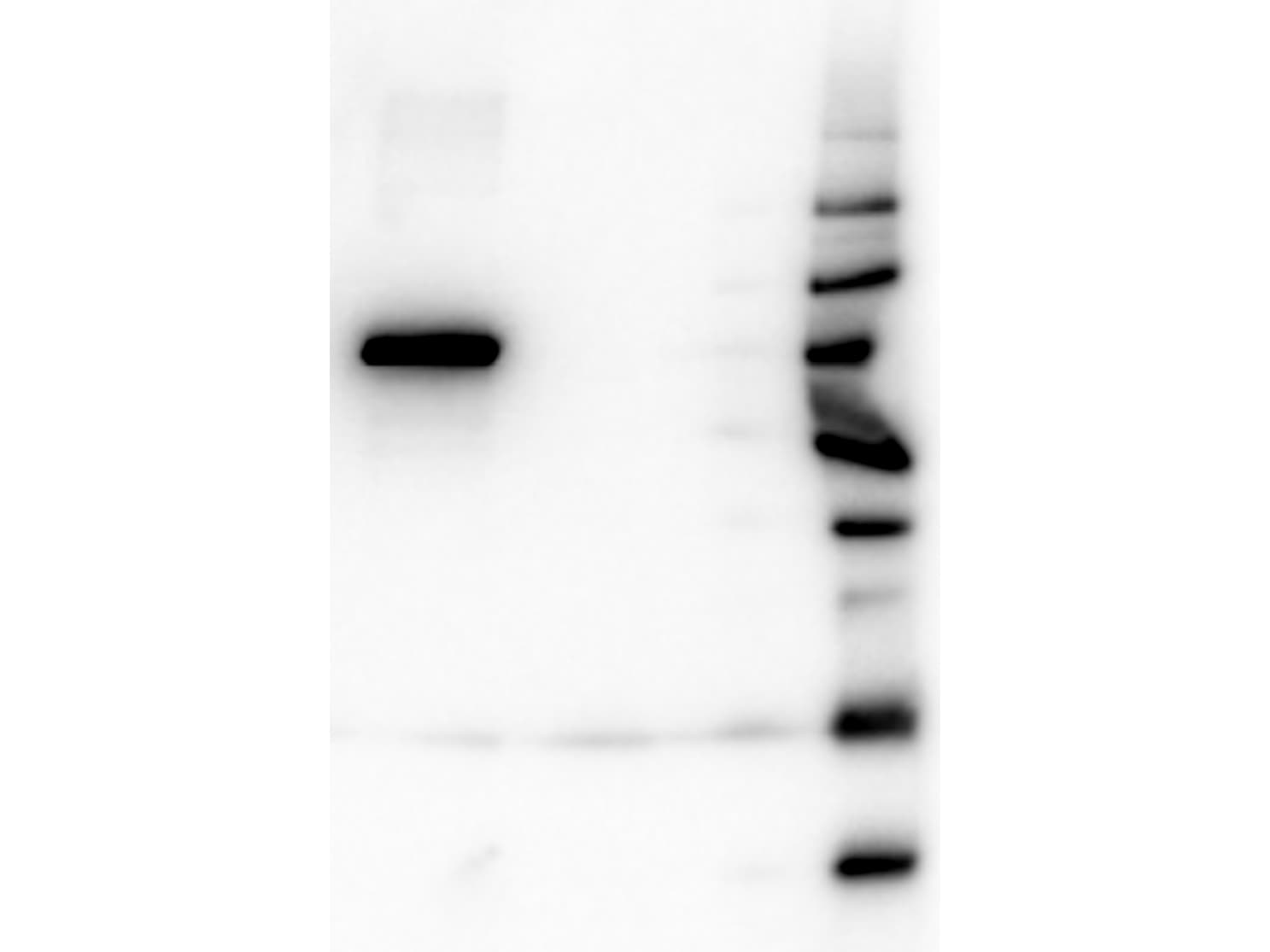 Monoclonal Mouse anti-Human AKT1 Antibody (clone 14E5.A2.B2.H9, Internal, IHC, WB)