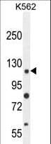 ANKRD52 Antibody (aa433-461)