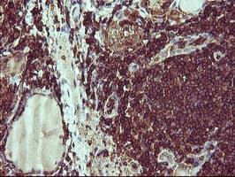 IHC-plus™ CD45 / LCA Antibody (clone 4C11)