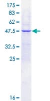 Human UBE2E1 / UBCH6 Protein (Recombinant GST)