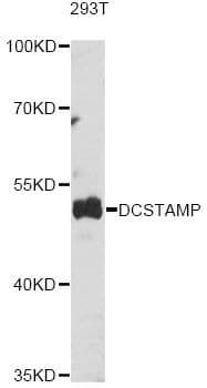 Polyclonal Rabbit anti-Human TM7SF4 / DC-STAMP Antibody (WB)