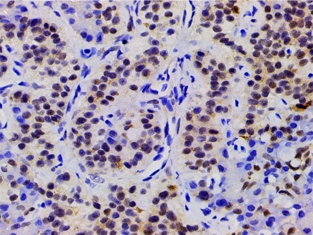 CFL1 / Cofilin Antibody (phospho-Ser3)