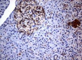 PIK3CD / PI3K Delta Antibody (aa286-610, clone OTI2H3)