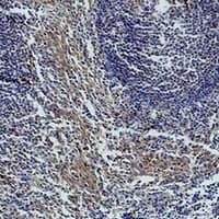 Monoclonal Mouse anti-Human CASP3 / Caspase 3 Antibody (IHC, WB)