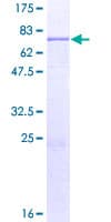 Human OPTIMEDIN / OLFM3 Protein (Recombinant GST)