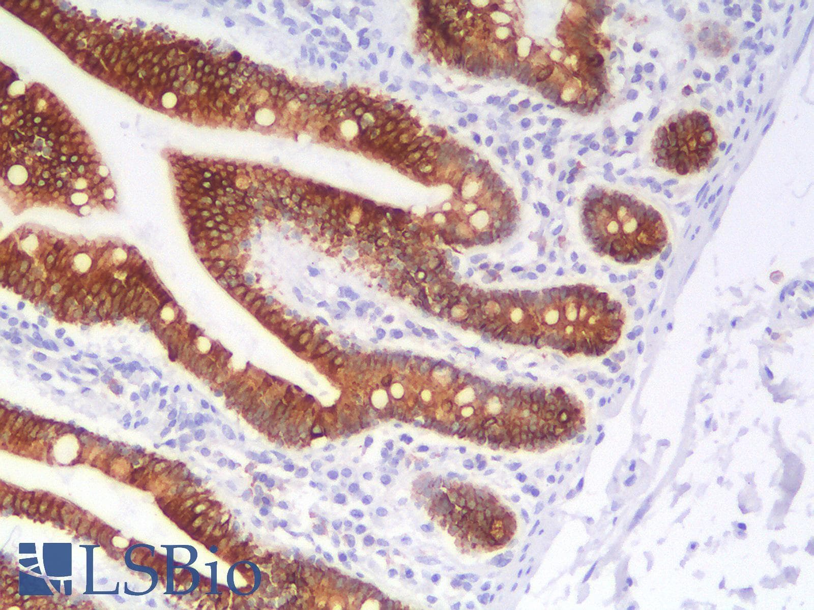 PathPlus™ Recombinant Monoclonal Rabbit anti-Human KRT18 / CK18 / Cytokeratin 18 Antibody (clone KRT18/2808R, IHC, IF, WB)