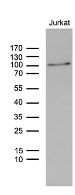 ZNF264 Antibody (clone OTI2A6)