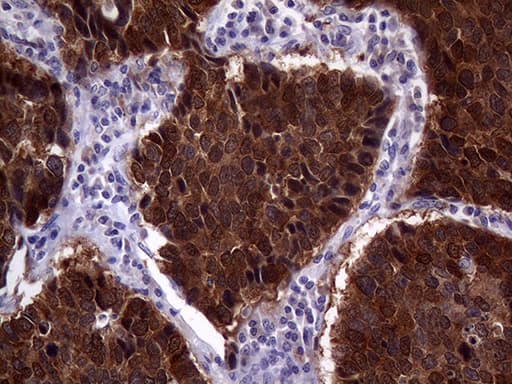 p16INK4a / CDKN2A Antibody (clone OTI10F12)