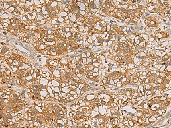QDPR / DHPR Antibody