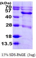 Human BCKDHA / BCKDE1A Protein (Recombinant His)