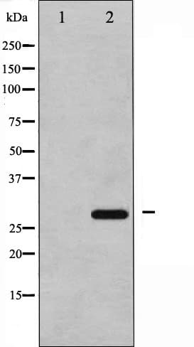 CDKN1B / p27 Kip1 Antibody (phospho-Thr187)