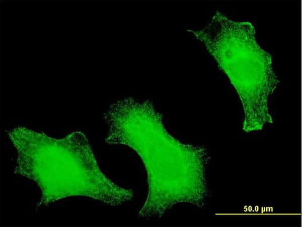 FOXO3 / FOXO3A Antibody (clone 1E11)