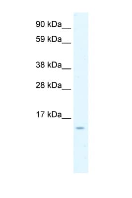 CCL7 / MCP3 Antibody (aa30-79)