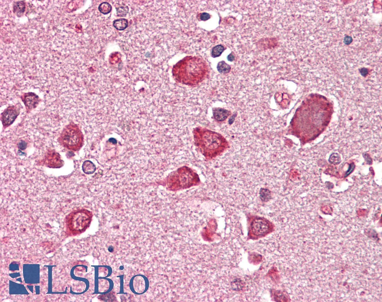 IHC-plus™ GABRA6 Antibody (aa15-26)