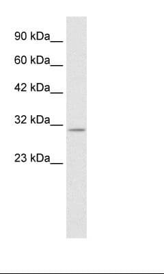 KCNIP4 / KCHIP4 Antibody (aa27-76)