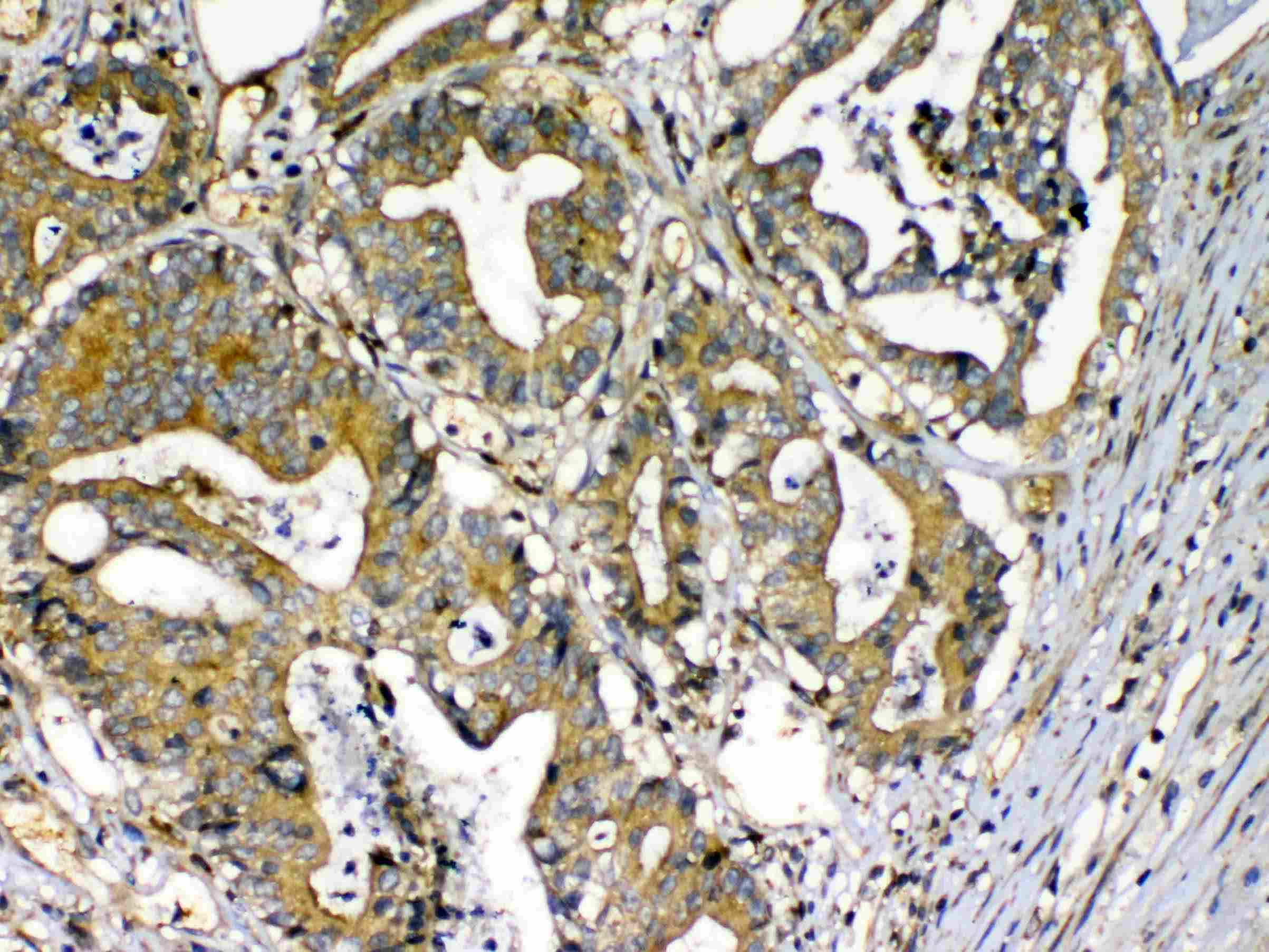 CFD / Factor D / Adipsin Antibody
