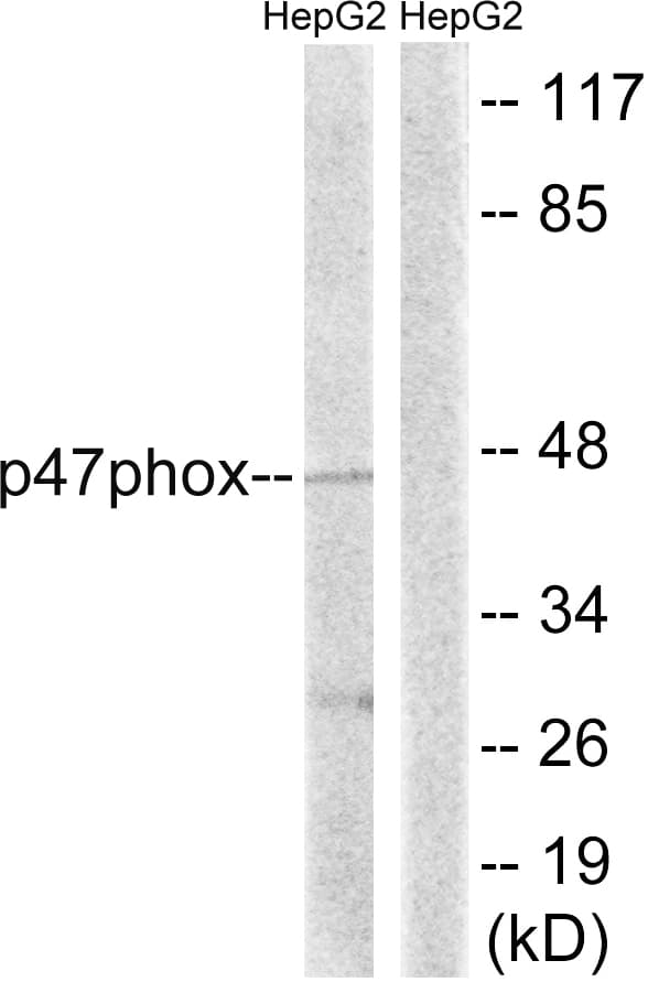 NCF1 / p47phox / p47 phox Antibody (aa311-360)
