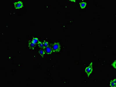 Polyclonal Rabbit anti-Human GLUL / Glutamine Synthetase Antibody (IHC, IF, WB)