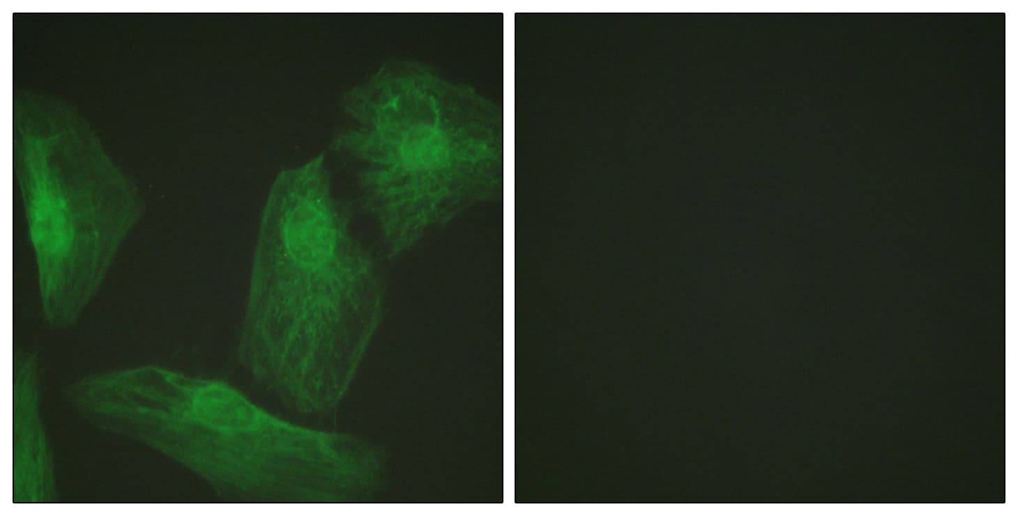 SMAD2 Antibody (aa186-235)