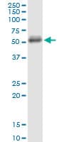 Monoclonal Mouse anti-Human CD5 Antibody (clone 2F7, WB)