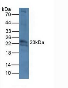 CRYBB2 Antibody (aa17-191, APC, Cy7)