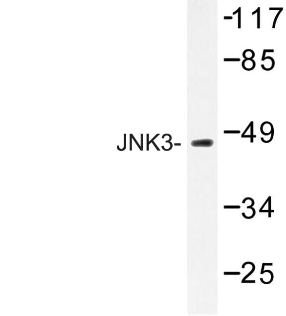 MAPK10 / JNK3 Antibody (Lys391)