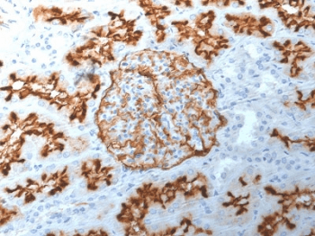 MME / CD10 Antibody (clone MME/1892)
