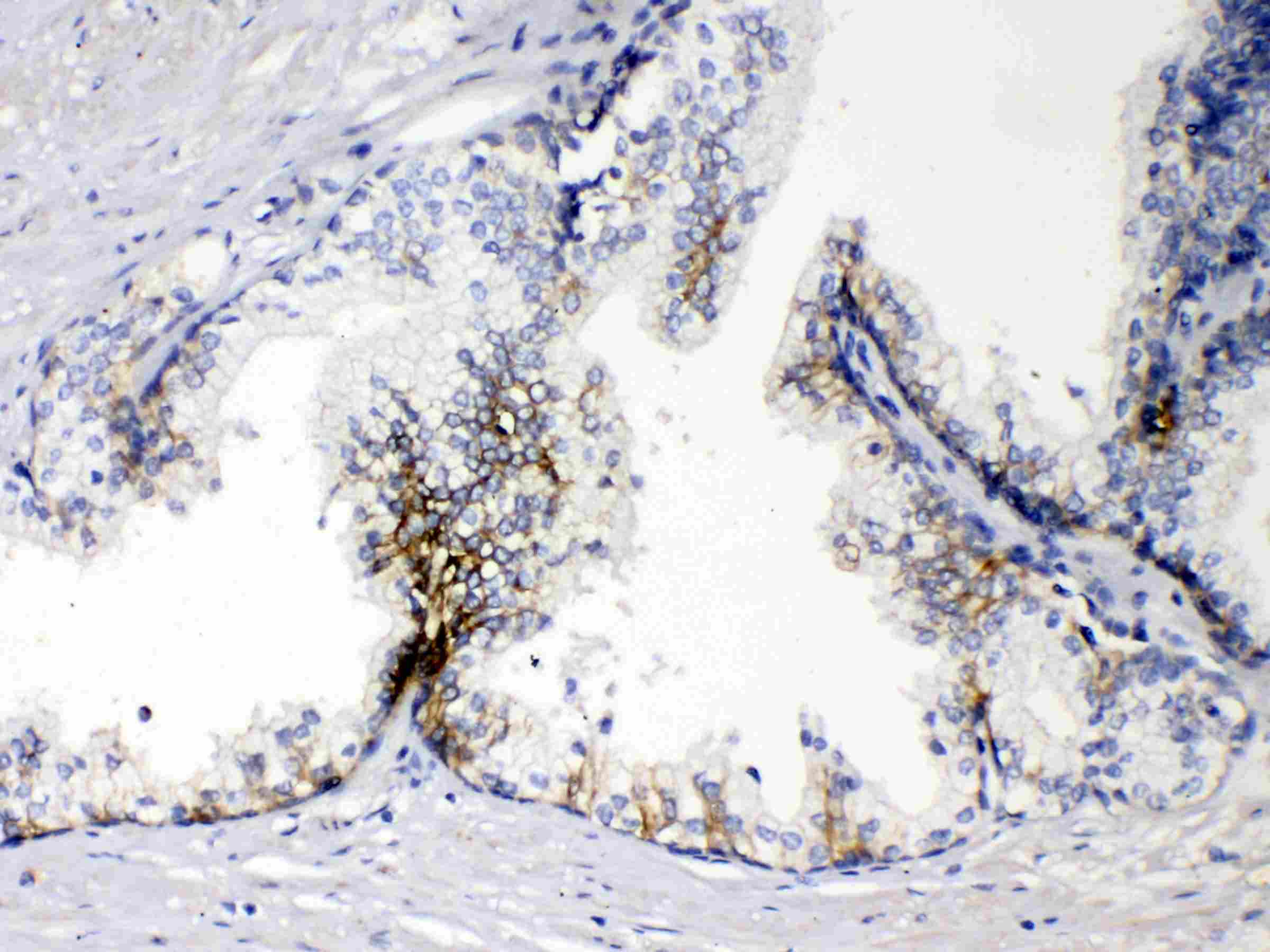 EPCAM Antibody
