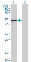 PathPlus™ Monoclonal Mouse anti-Human CALR / Calreticulin Antibody (clone 1G11-1A9, IHC, WB)
