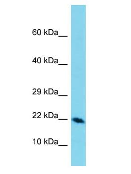 Polyclonal Rabbit anti-Human DEFB129 Antibody (aa108-157, IHC, WB)