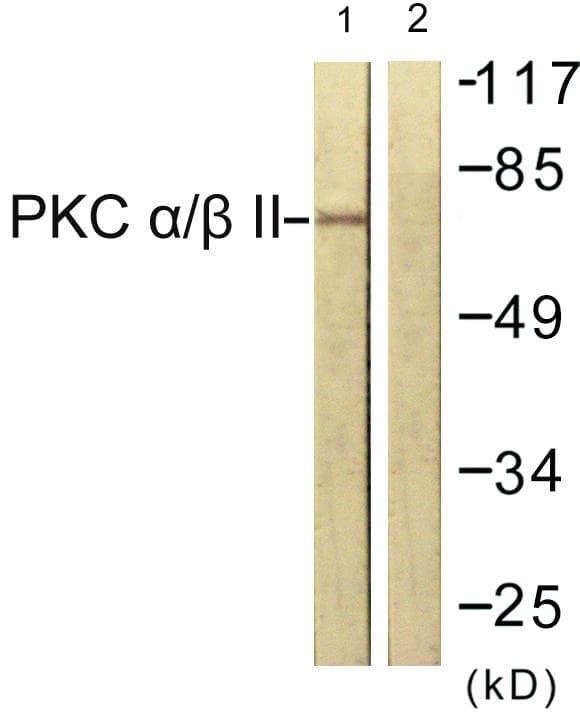Polyclonal Rabbit anti-Human PRKCA / PKC-Alpha Antibody (p638, IHC, WB)