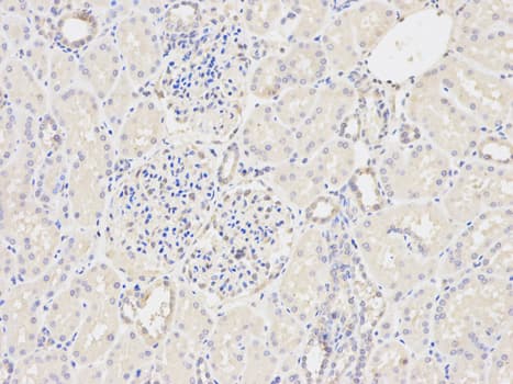 GSTM2 Antibody