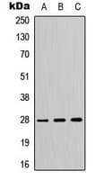Polyclonal Rabbit anti-Human YWHAQ / 14-3-3 Theta Antibody (C-Terminus, IHC, IF, WB)