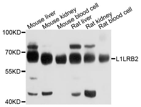 IHC-plus™ Polyclonal Rabbit anti-Human LILRB2 / ILT4 Antibody (IHC, WB)