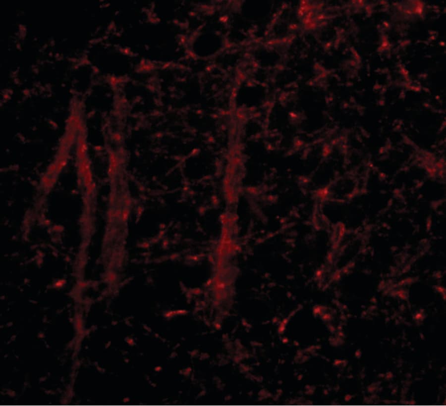 IHC-plus™ Polyclonal Rabbit anti-Human GLE1 Antibody (IHC, IF, WB)