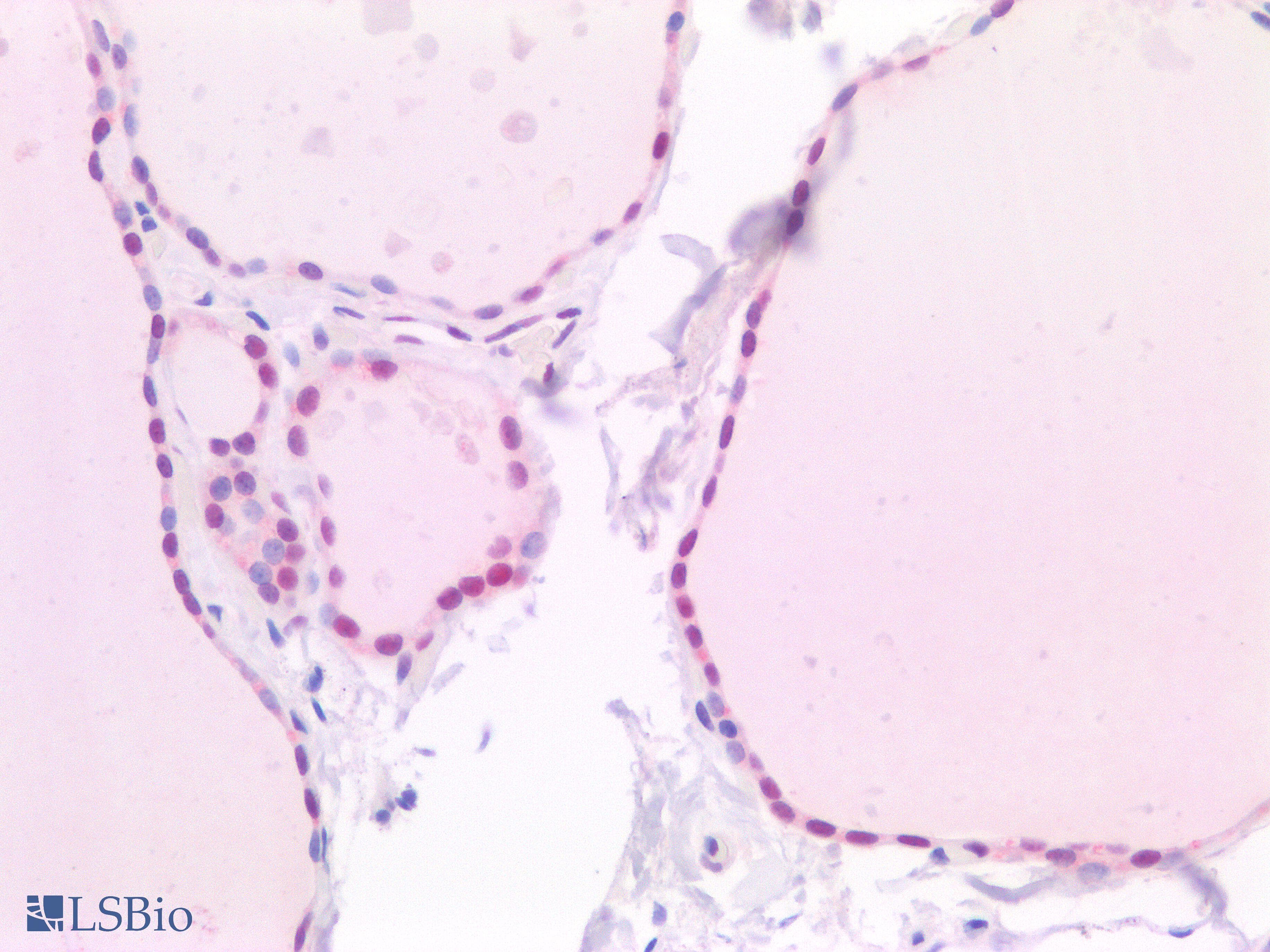 PathPlus™ Monoclonal Mouse anti-Human TFE3 Antibody (clone AHC0245, Ready-to-Use, IHC, WB)