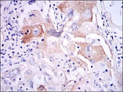 Monoclonal Mouse anti-Human IL-1B / IL-1 Beta Antibody (clone 3A6, IHC, IF, WB)