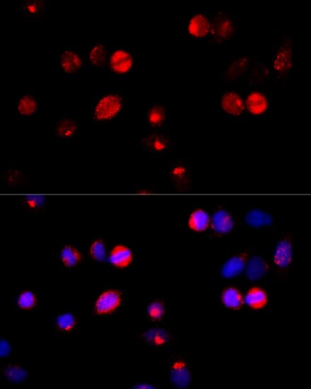 HSPA5 / GRP78 / BiP Antibody