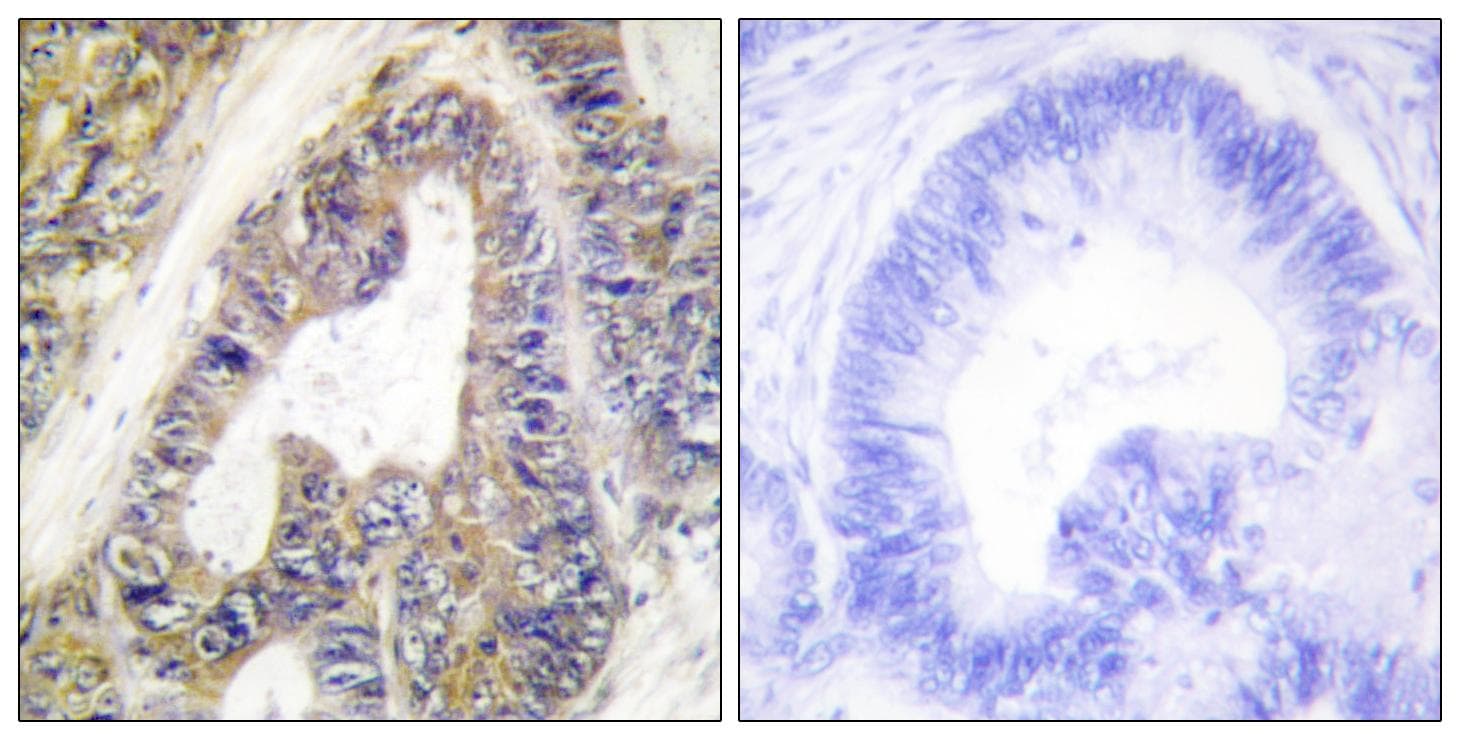 EPS8L1 Antibody