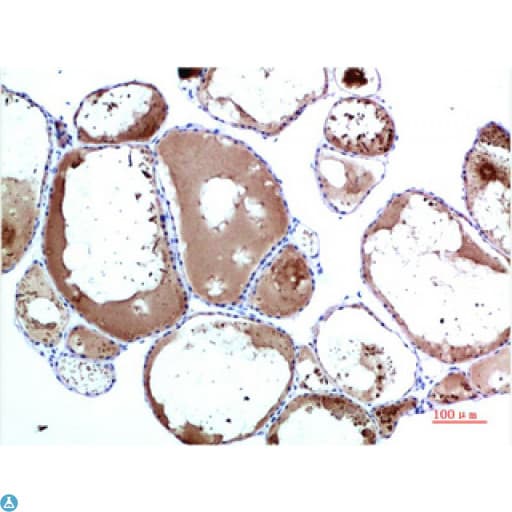 TTR / Transthyretin Antibody