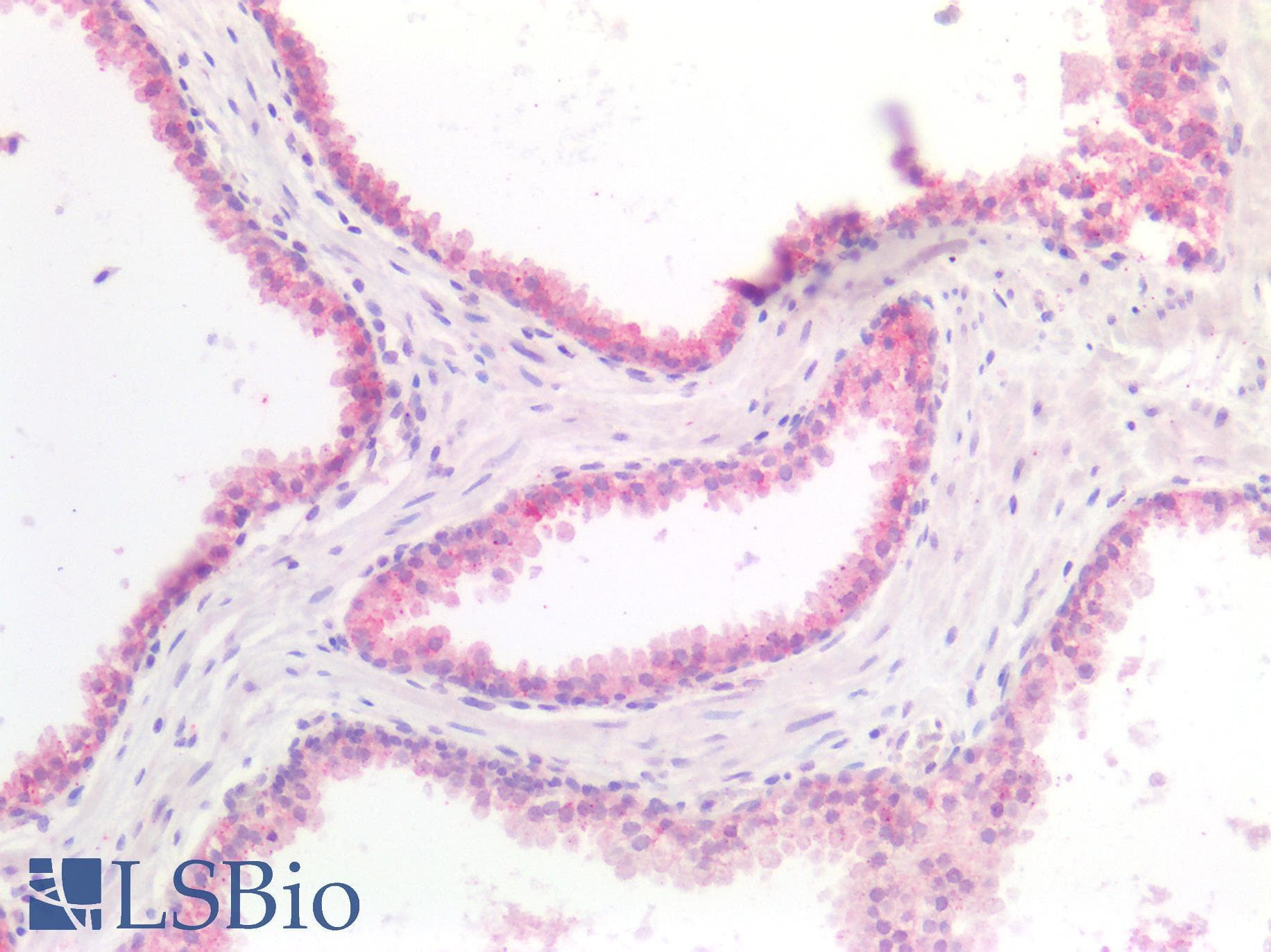 IHC-plus™ 5-Alpha Reductase / SRD5A1 Antibody