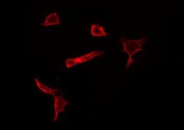Polyclonal Rabbit anti-Human C1orf35 / MMTAG2 Antibody (IF, WB)