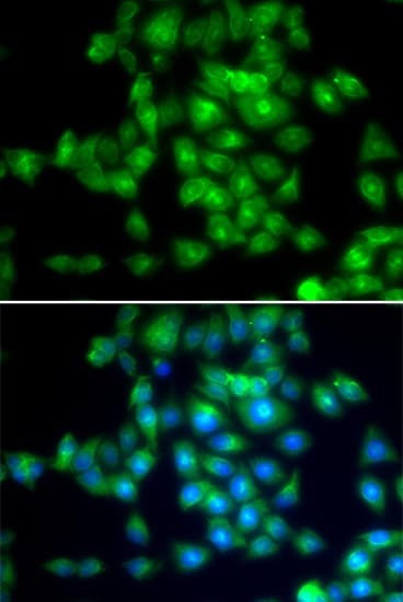 SIRT3 / Sirtuin 3 Antibody