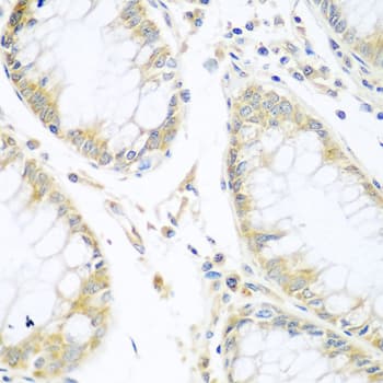 CUL3 / Cullin 3 Antibody