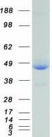 Human XRCC4 Protein (Recombinant Myc-DDK (Flag))
