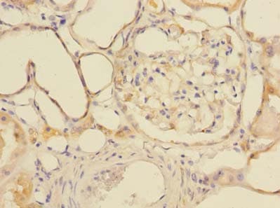 GDPD2 / GDE3 Antibody