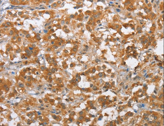MLH1 Antibody