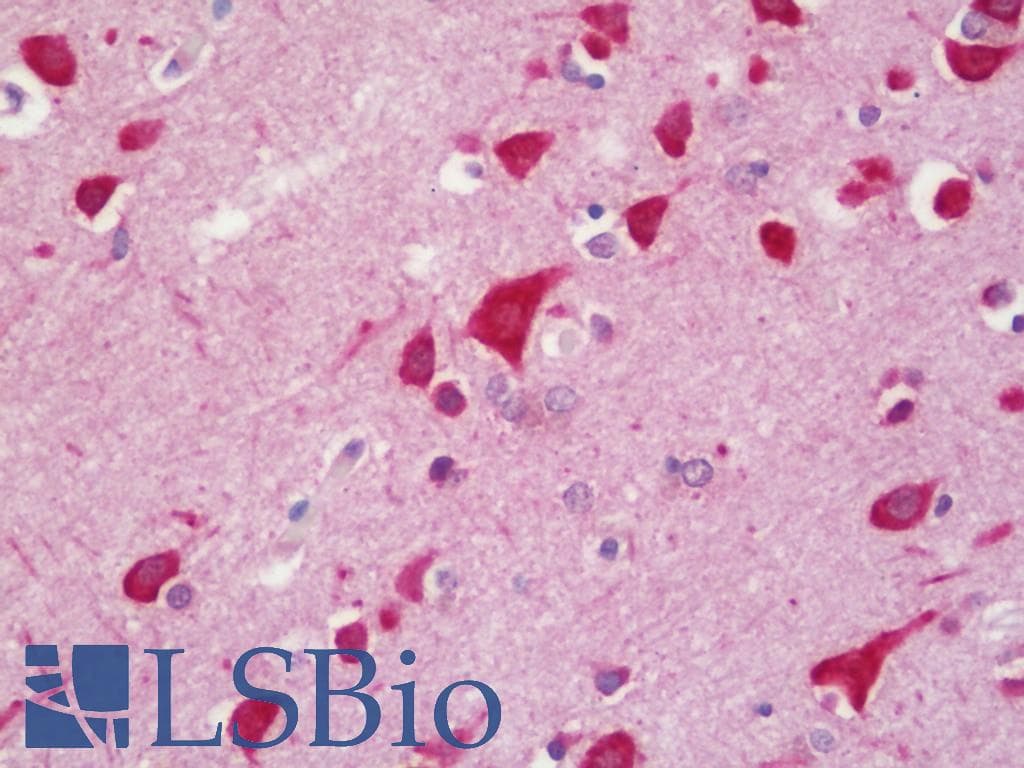 IHC-plus™ MYD88 Antibody (clone 1B4)